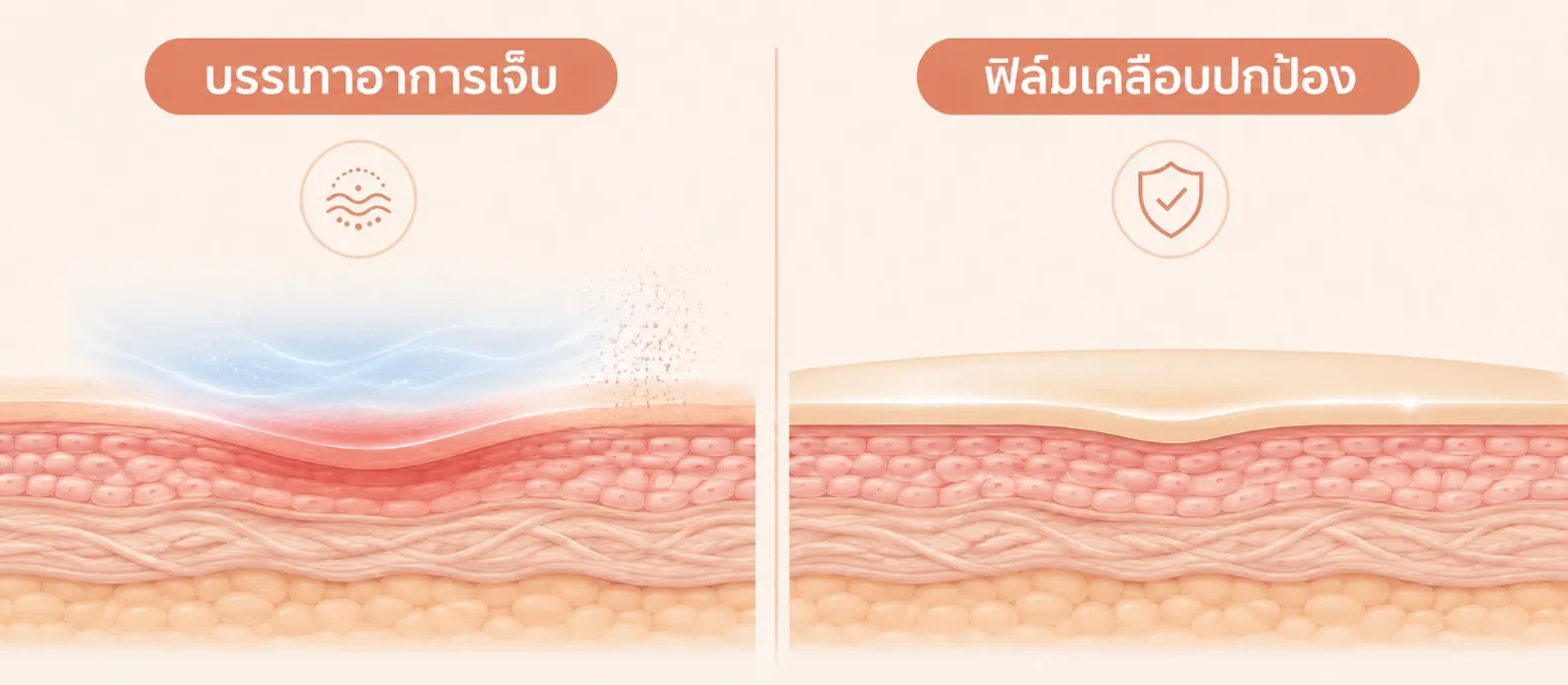 ภาพเปรียบเทียบระหว่างการลดปวดกับการเคลือบแผล
